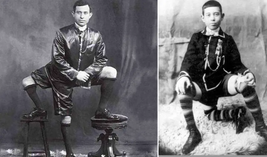 Frank Lentini, Three Legged Man With 16 Fingers, And Two Penises