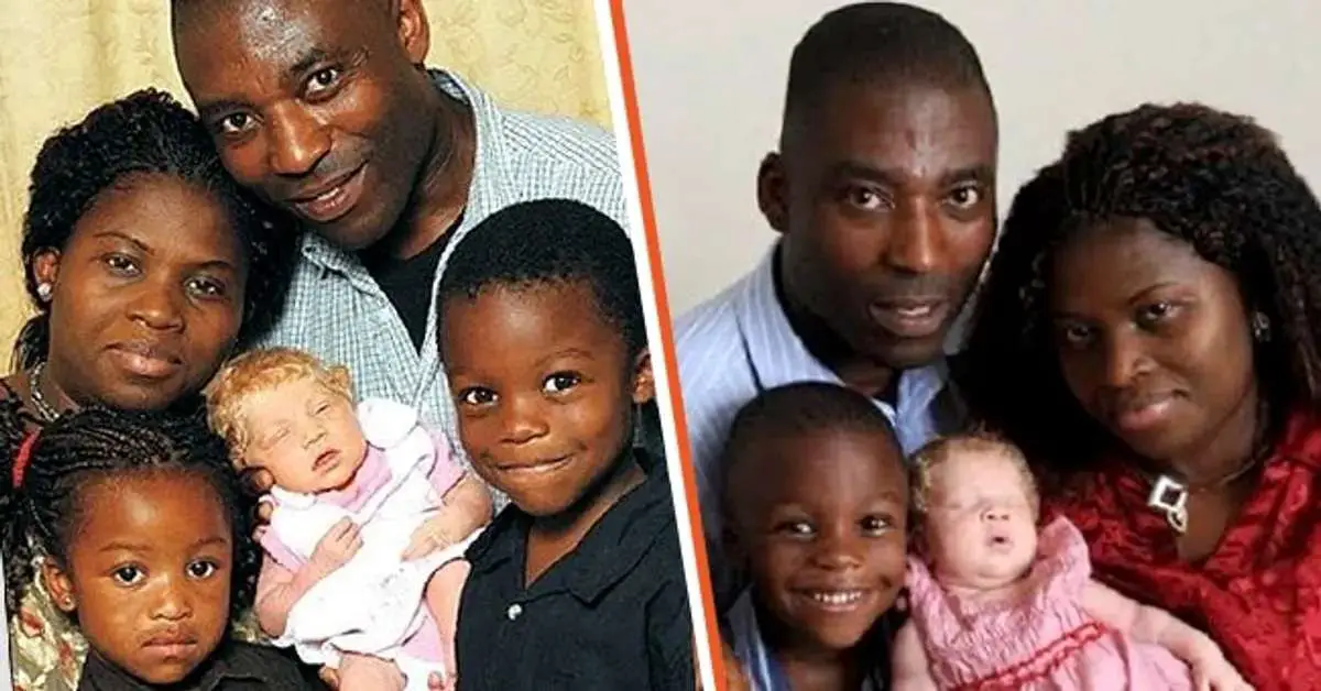 Nmachi Ihegboro A Black Couple Delivers Blonde, BlueEyed "A Miracle